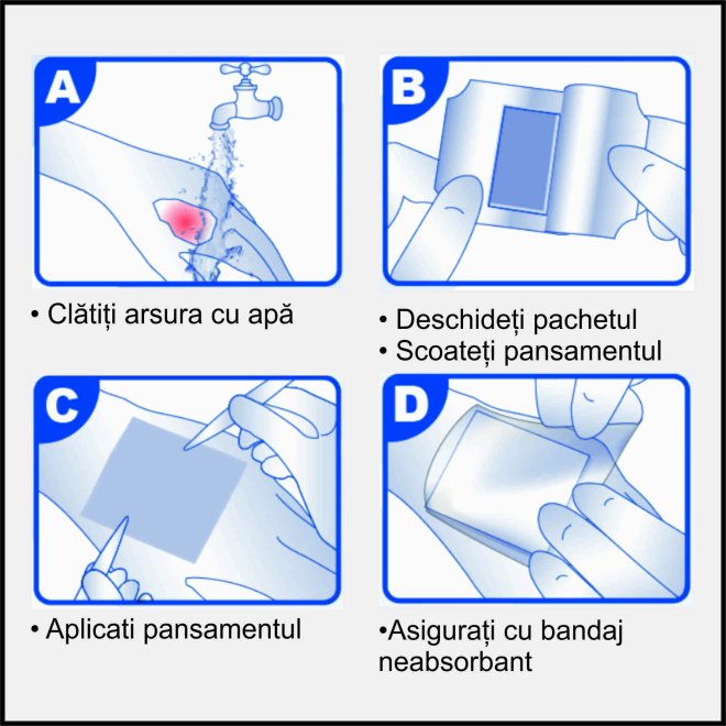  Comprese sterile pentru arsuri impregnate cu hidrogel 30x40cm